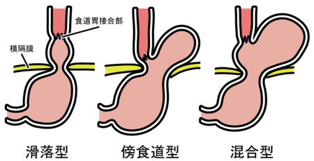 グラフィックス3.png