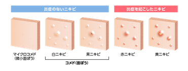 画像2.png